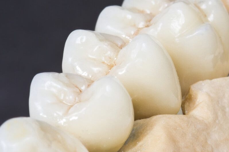 протезирование жевательных зубов металлокерамическими коронками в ТоталСтом