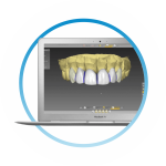 создание виртуальной модели зубов в компьютерной программе в стоматологии ТоталСтом