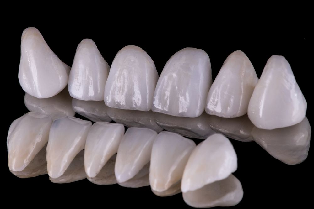 керамические виниры для зубов