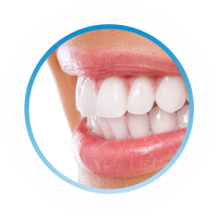 эстетика и незаметность лечения зубов в стоматологии ТоталСтом