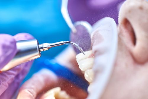 Профессиональная гигиена в стоматологии ТоталСтом